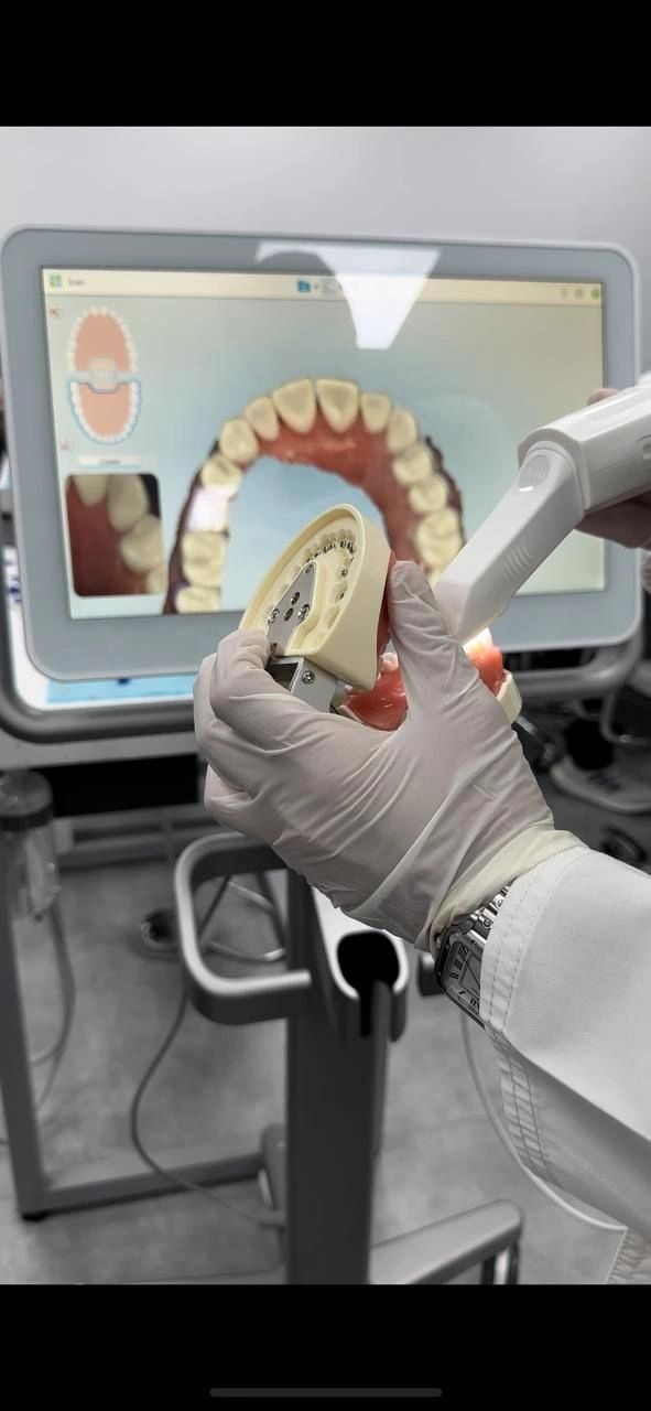 دورة العدسات الخزفية لتجميل الأسنان قدمها الإستشاري الدكتور محمد زربه