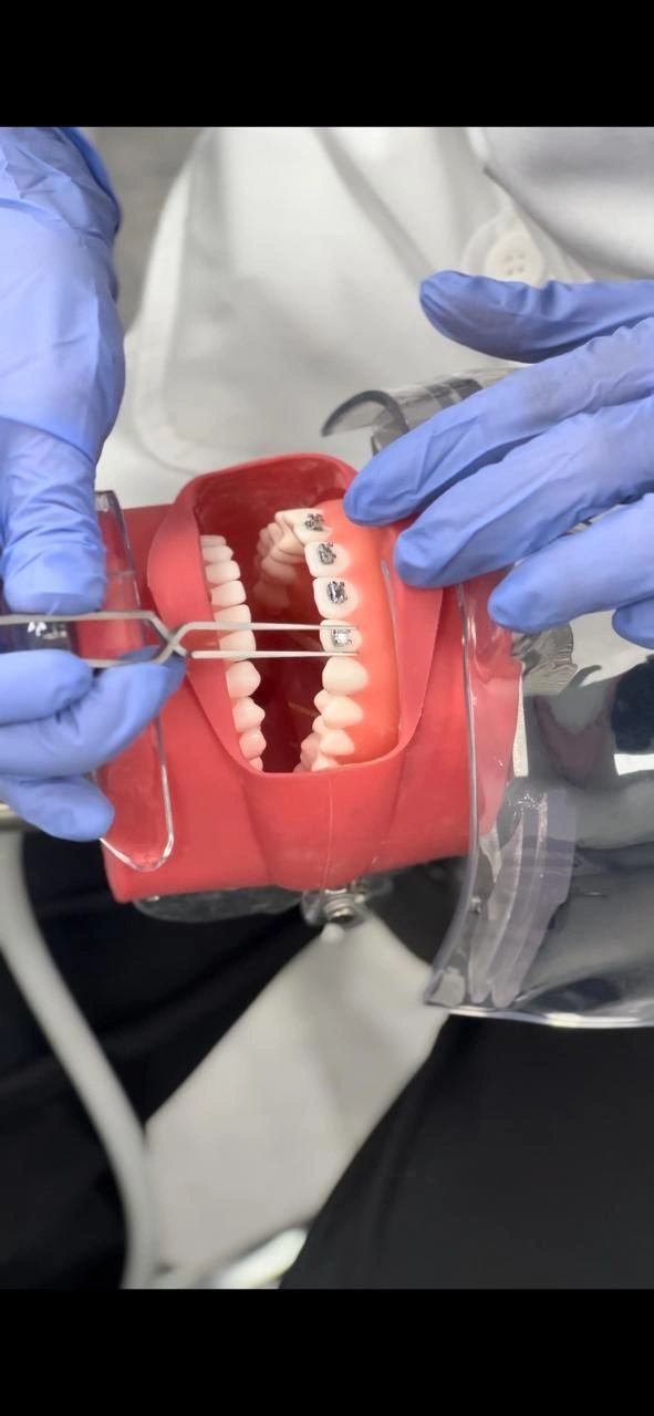 دورة العلاج التقويمي المحدود , التدخلي والبسيط التكميلي قدمها الإستشاري الدكتور علي الهيزعي